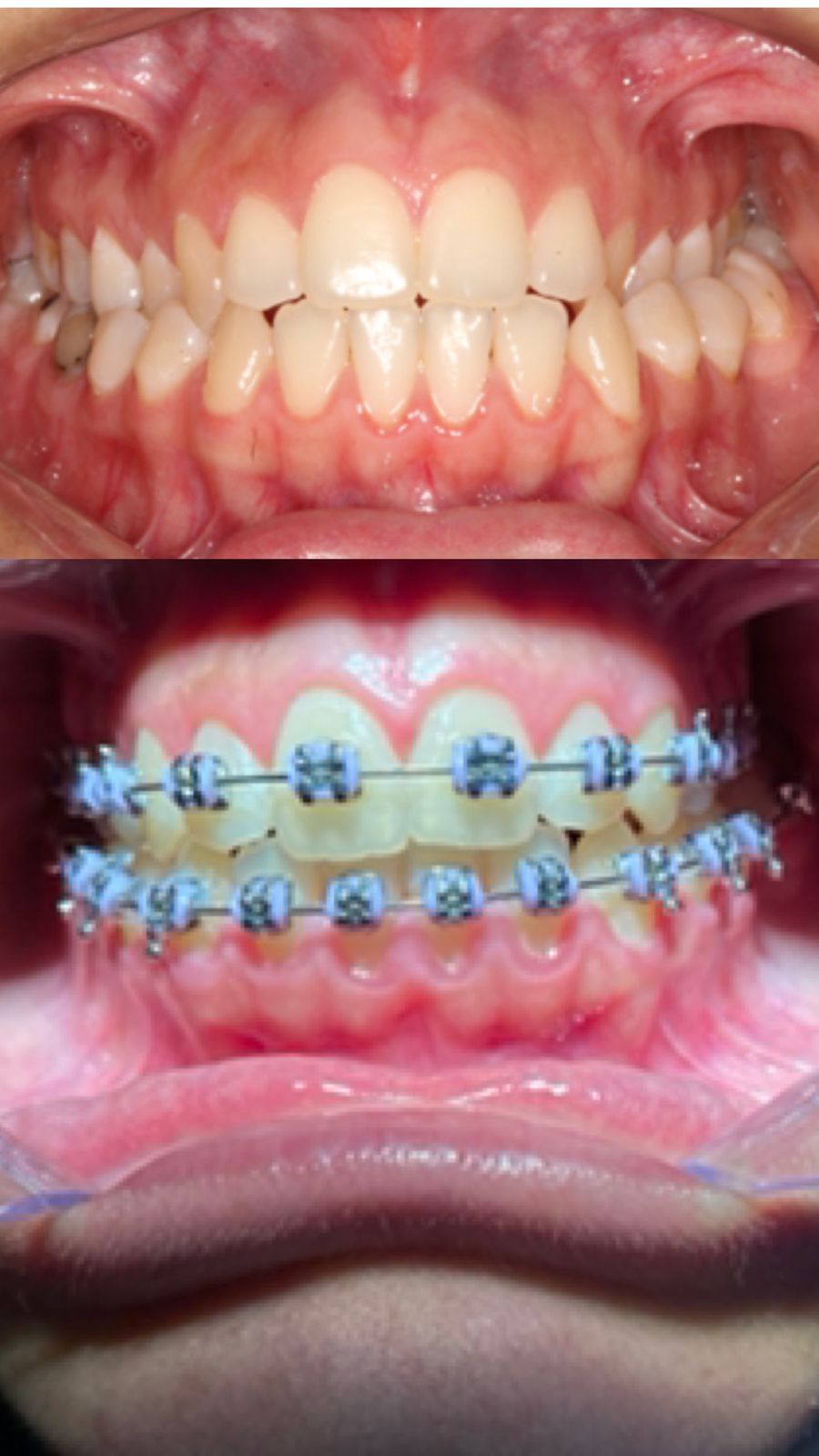 Francisco De Assis Almeida Lima Júnior-25