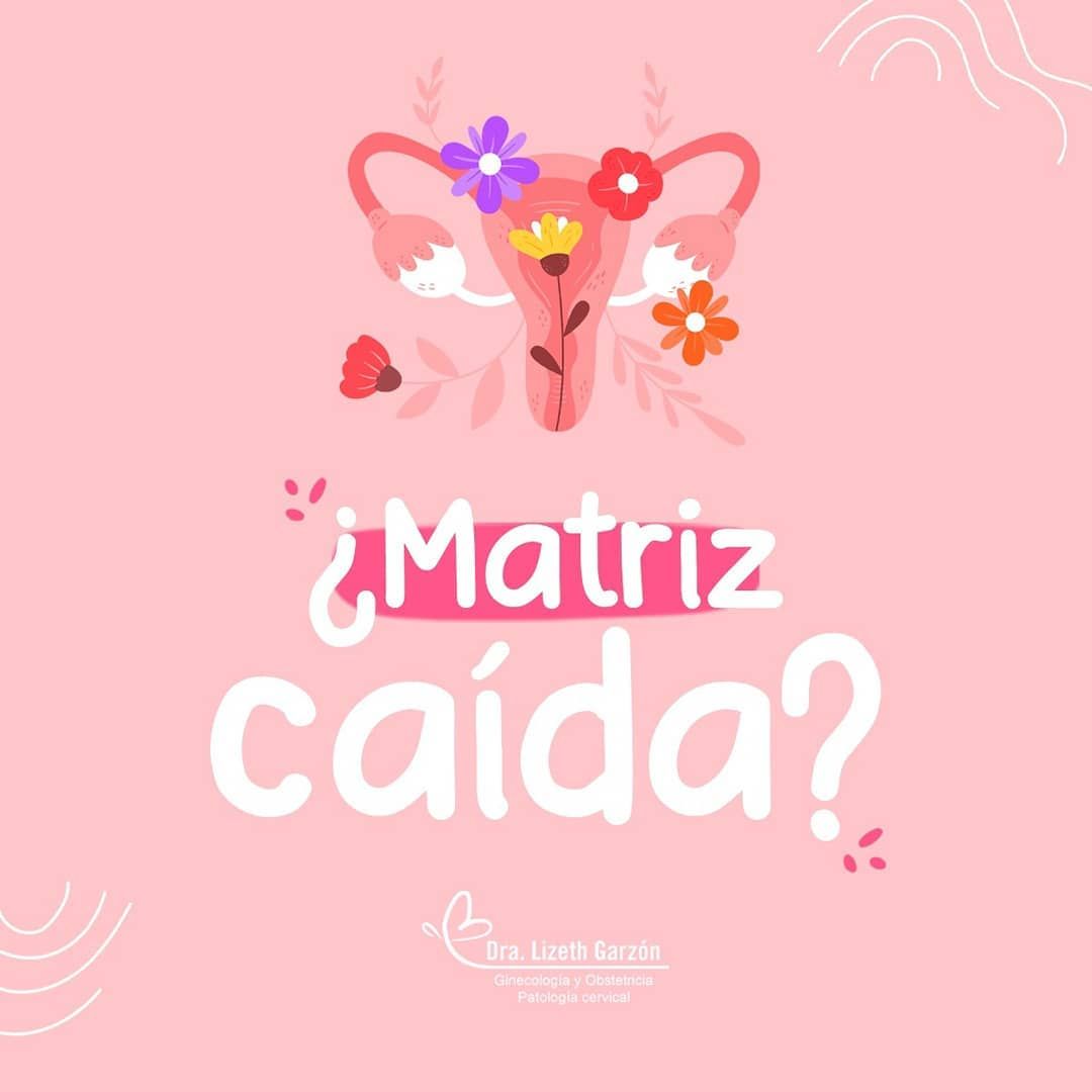 Lizeth Garzon Vargas-36