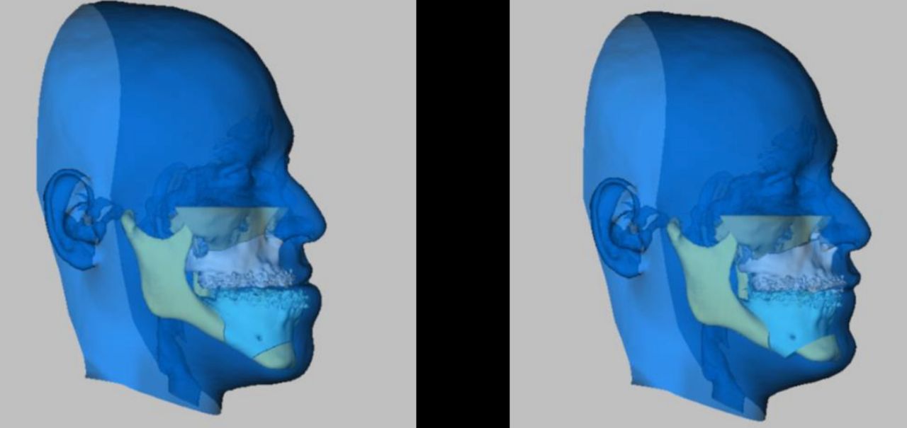 Vinicius Cavalcante-3