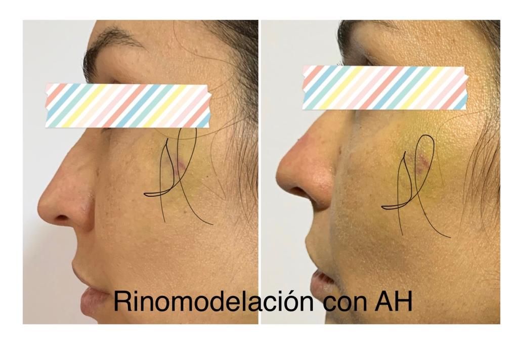 Maria Gisela Angel Losada-42