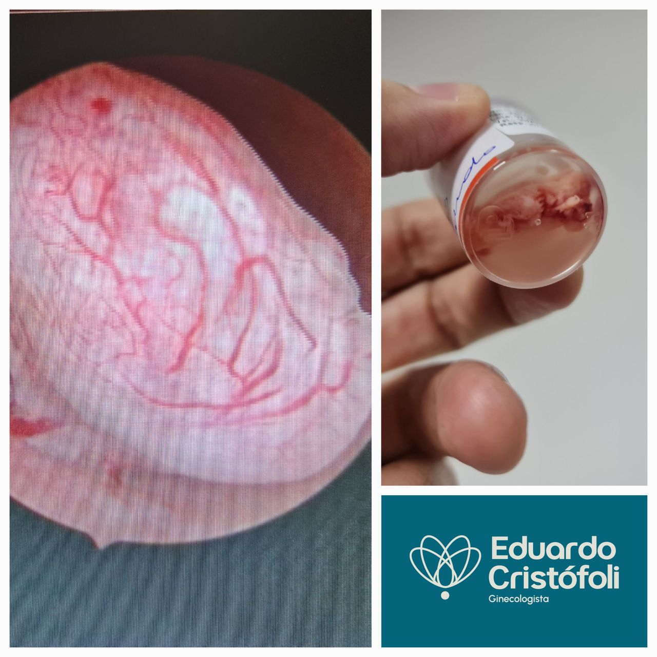 Eduardo Cristófoli Silva-13