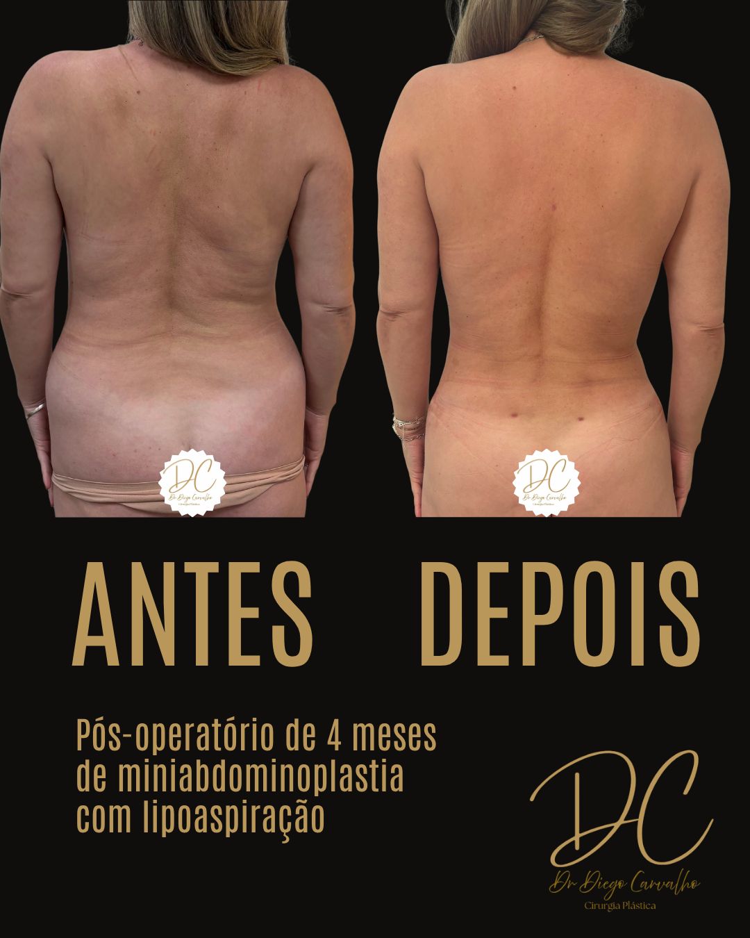 Diego Carvalho Maciel-22