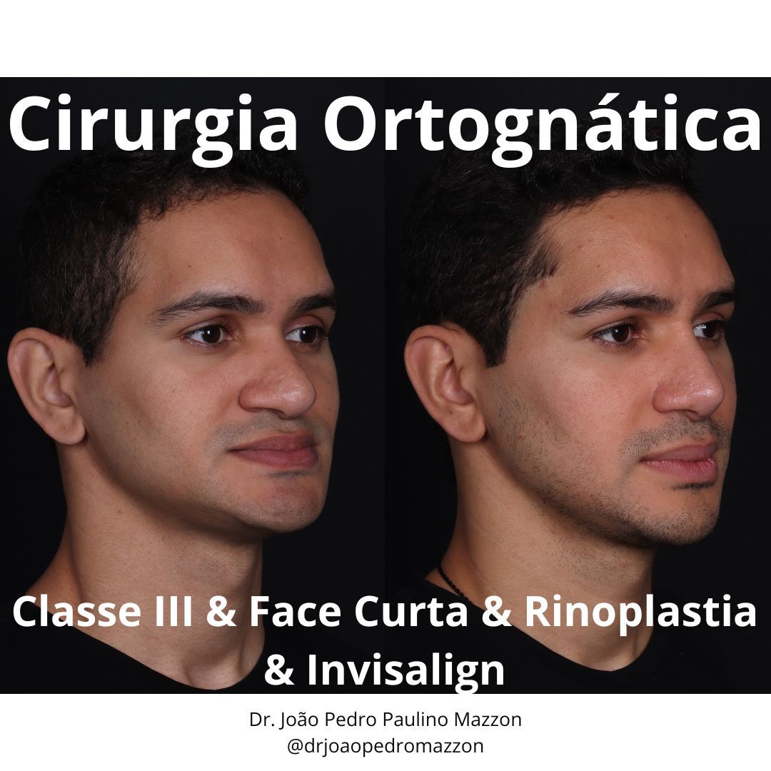 João Pedro Paulino Mazzon-12