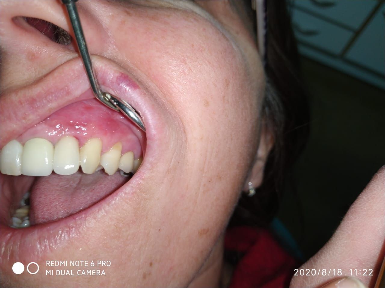 Pablo B. Azcárate-11