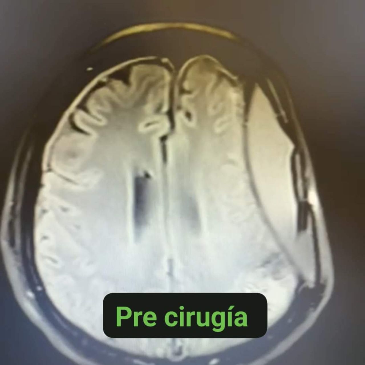 David Tafur Muñoz-1680