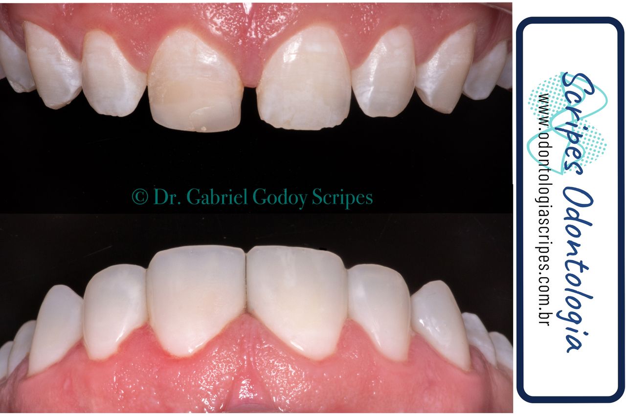 Gabriel Godoy Scripes-79