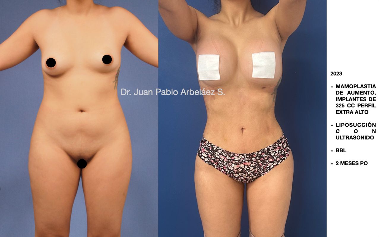 Juan Pablo Arbeláez Sierra-11