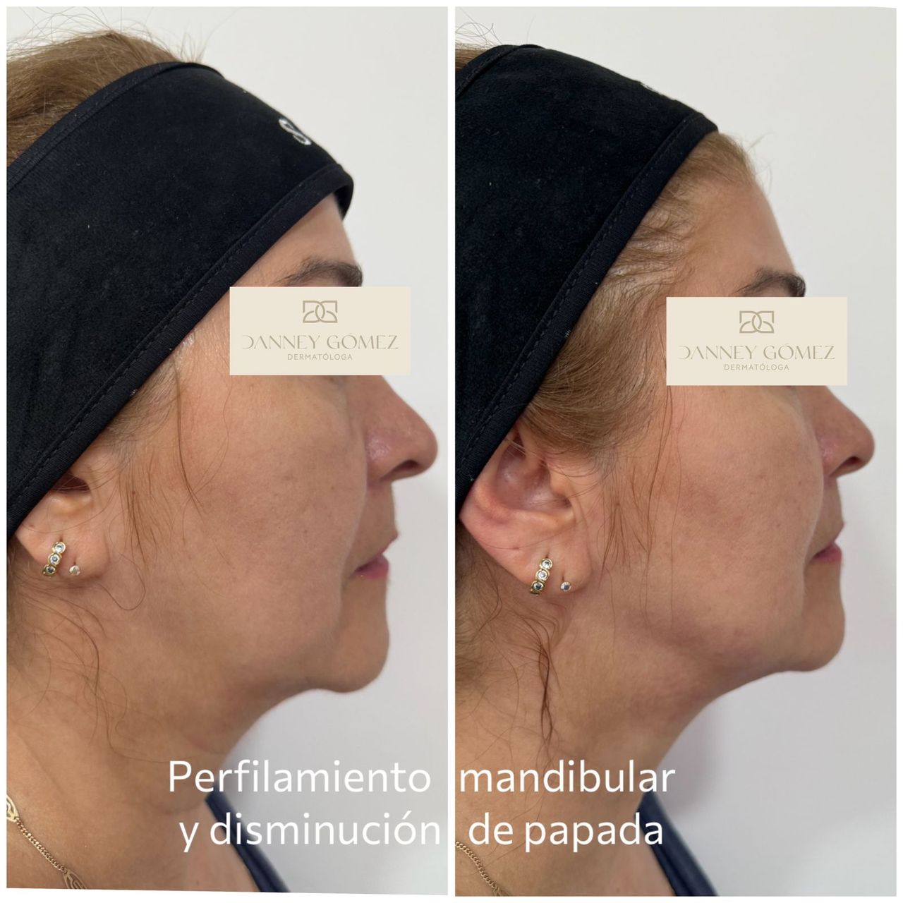 Danney Gomez Angulo-8