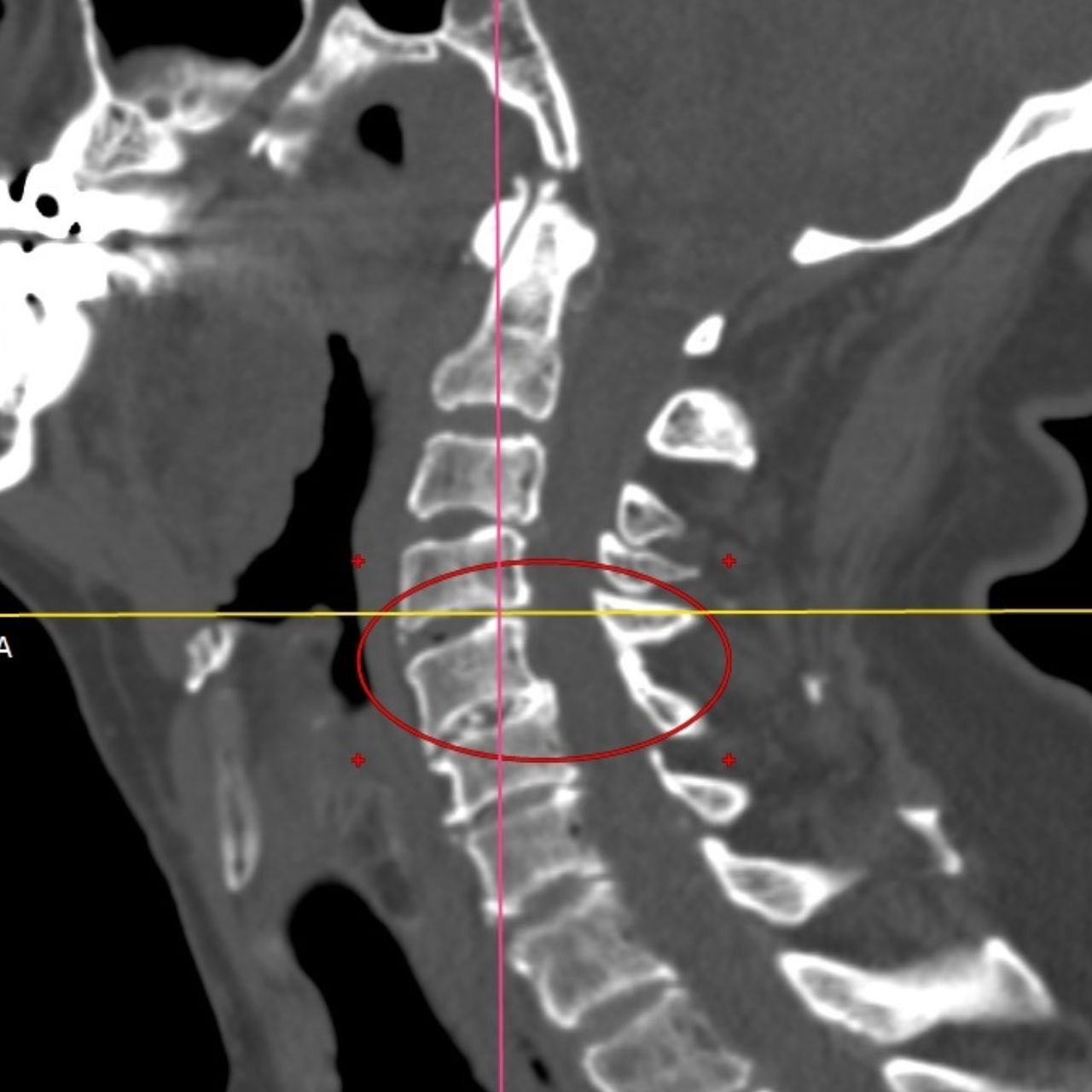 David Tafur Muñoz-1505
