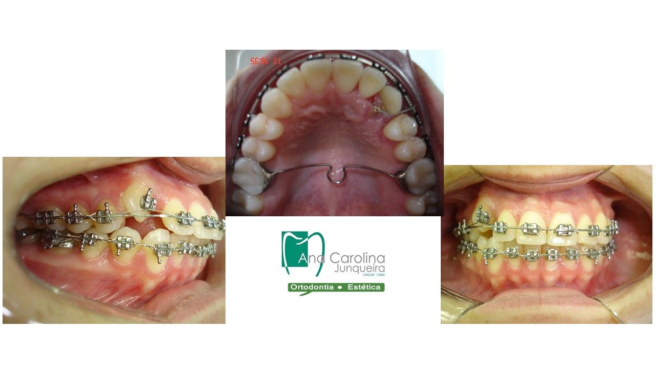 Ana Carolina Junqueira Defina-10