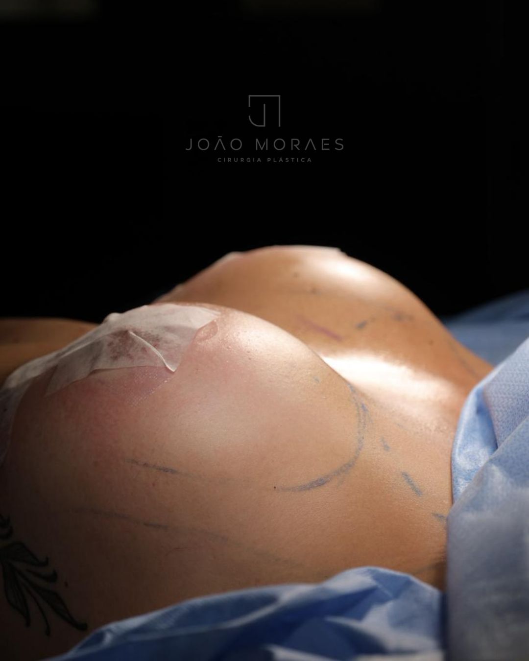 João Moraes-9