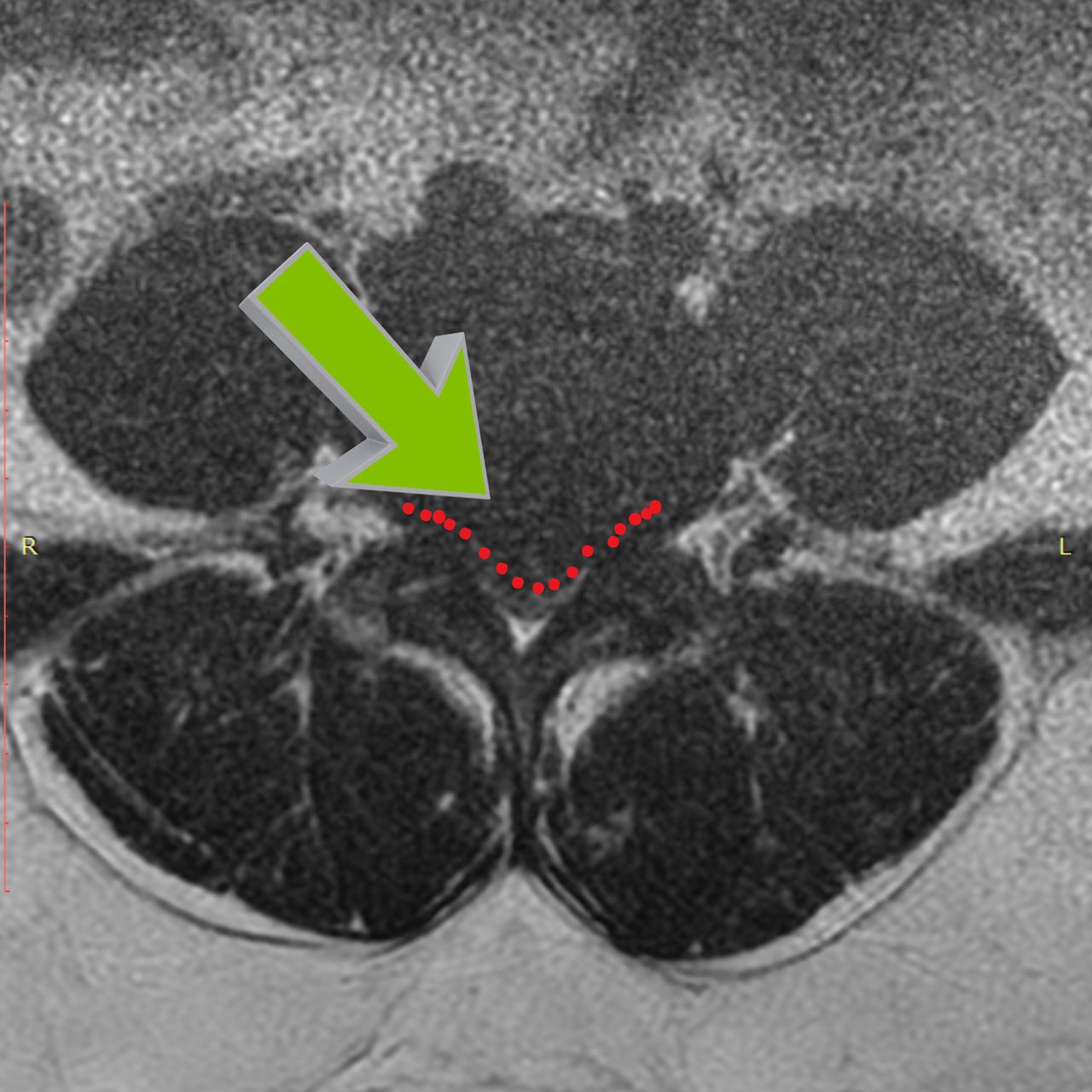 David Tafur Muñoz-2027