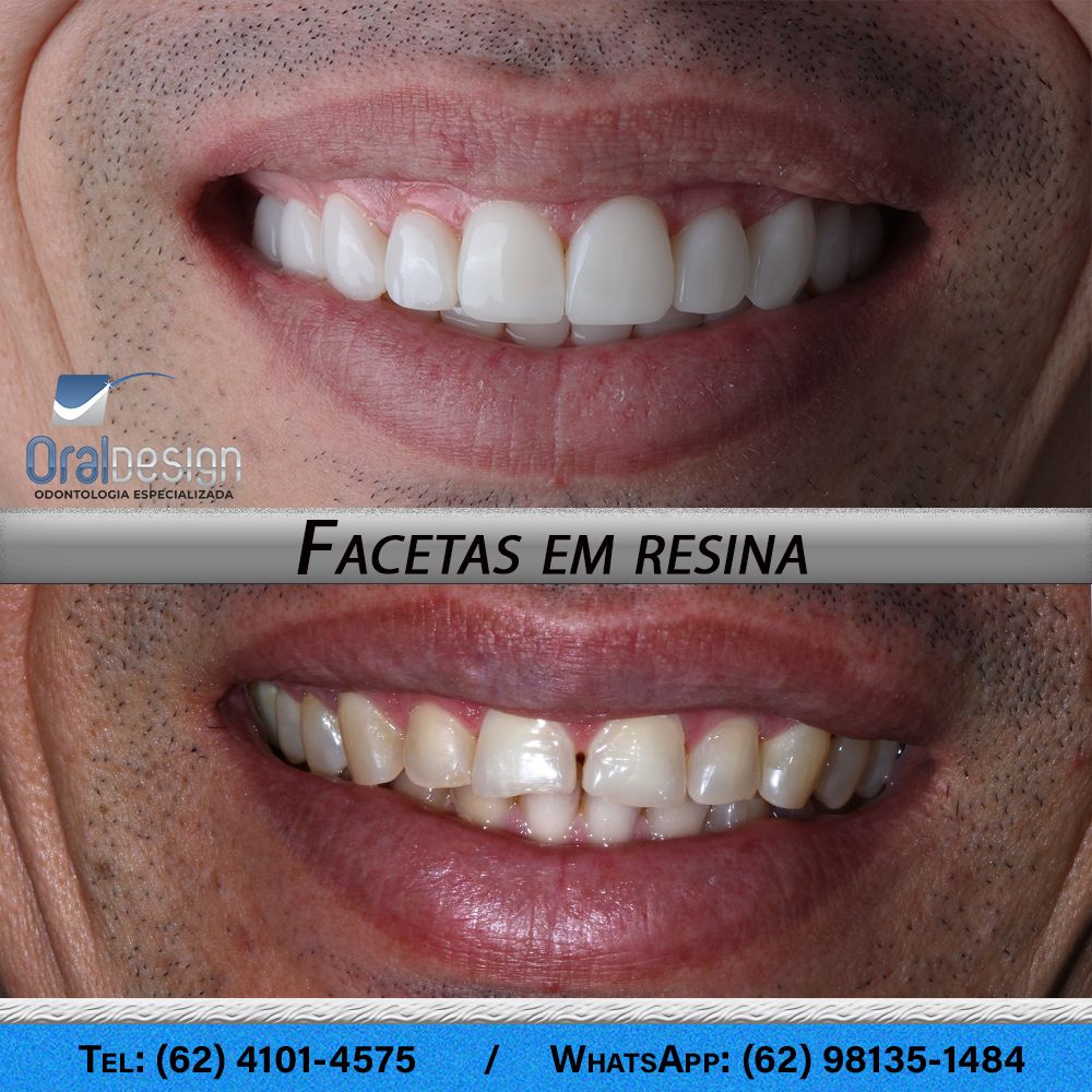 Danilo Monteiro Rezende Pereira-2