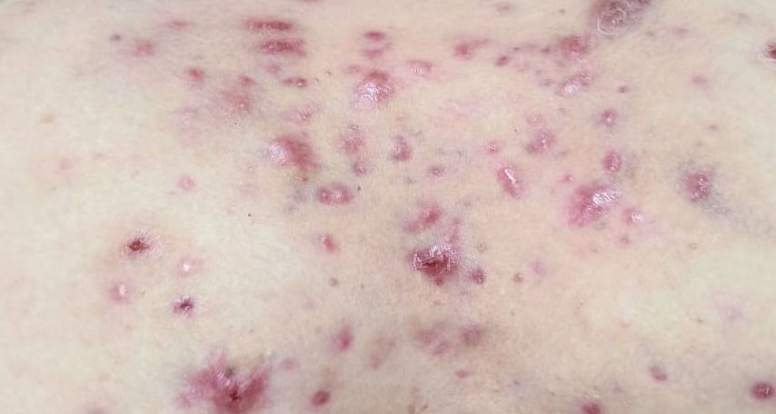 Marcos Ortiz Perez-5