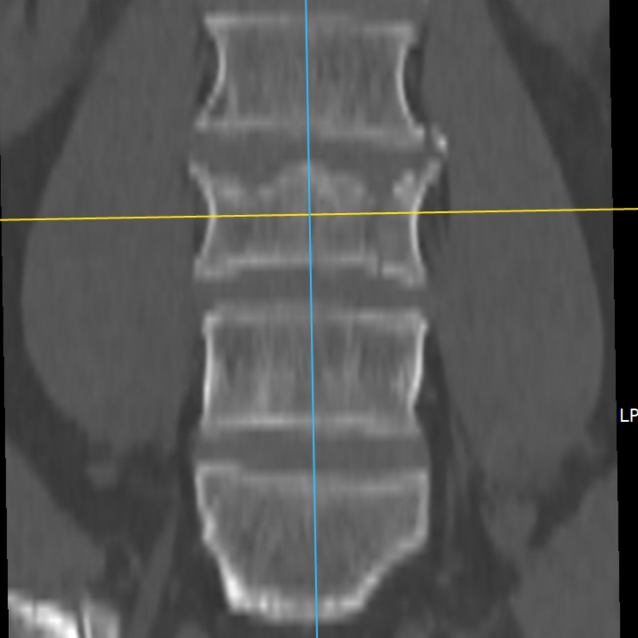 David Tafur Muñoz-2219