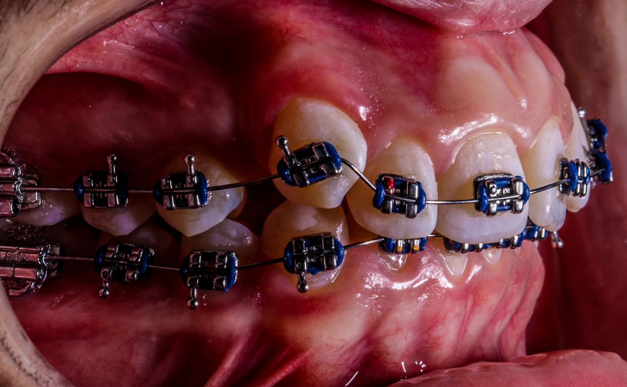 Roberto Soares Da Silva Júnior-11