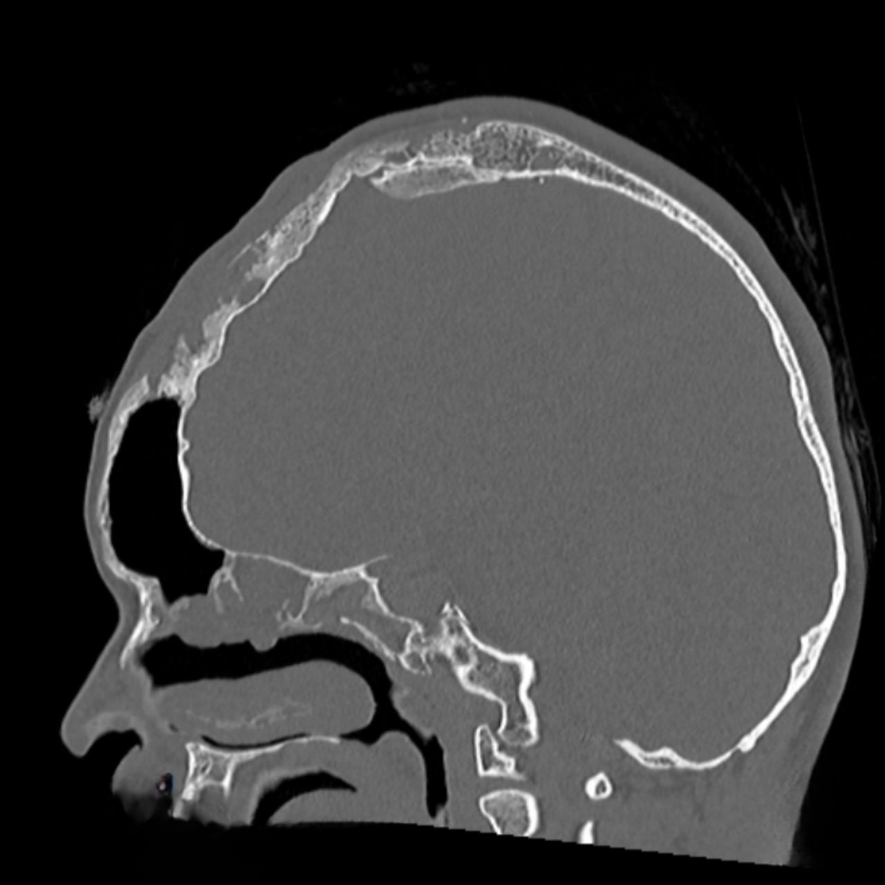 David Tafur Muñoz-1670