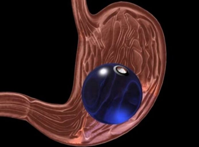 Guilherme Amadeu Poleto-40