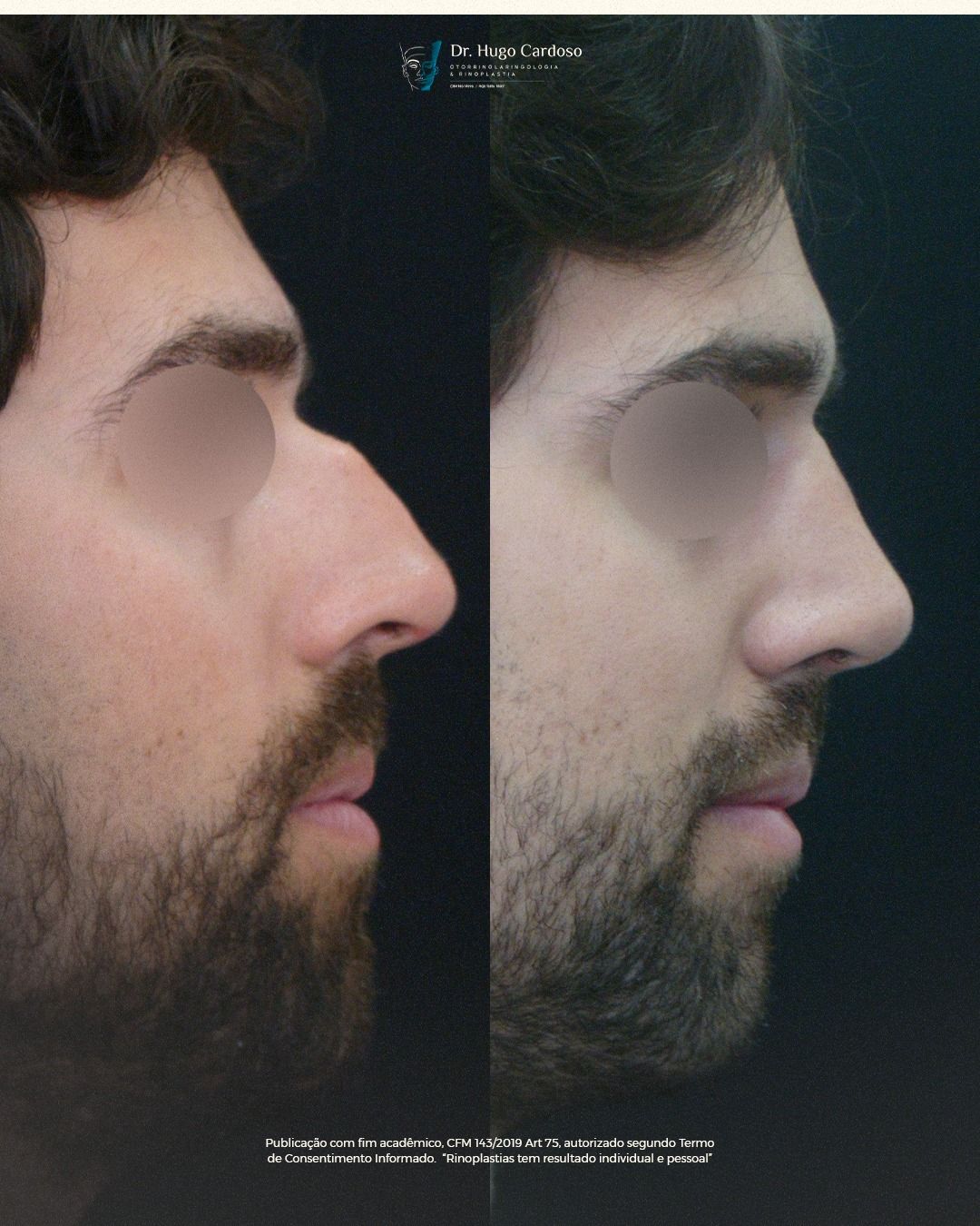 Hugo Cardoso De Oliveira-9