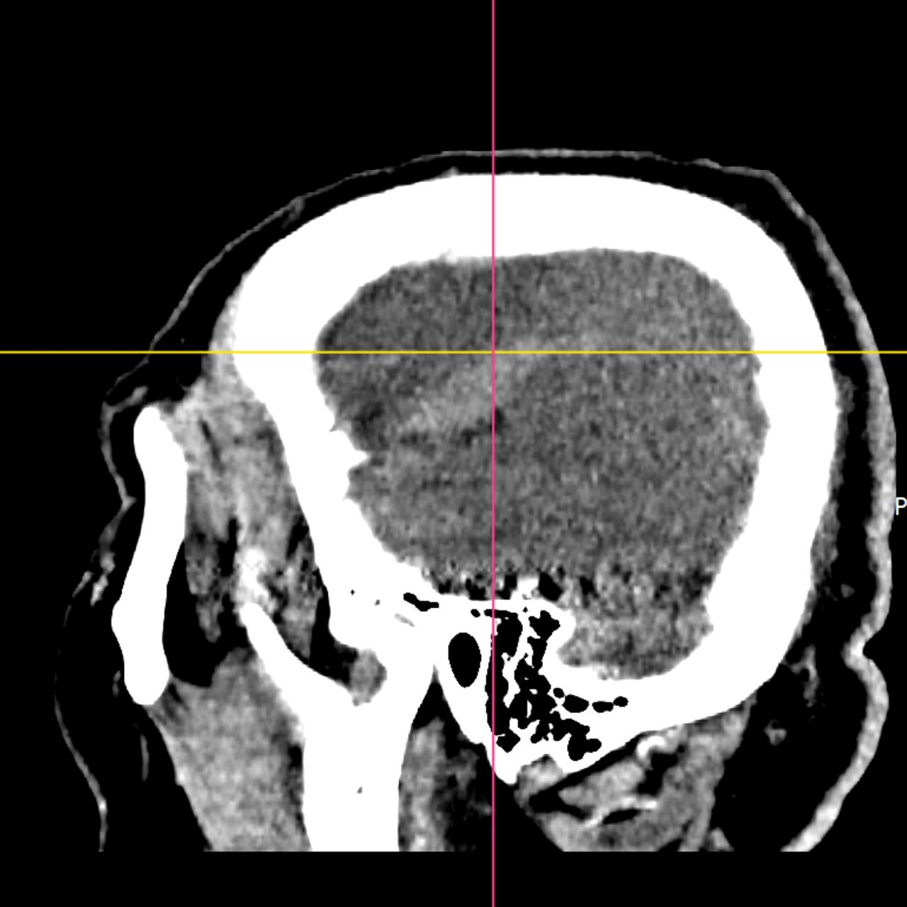 David Tafur Muñoz-2476