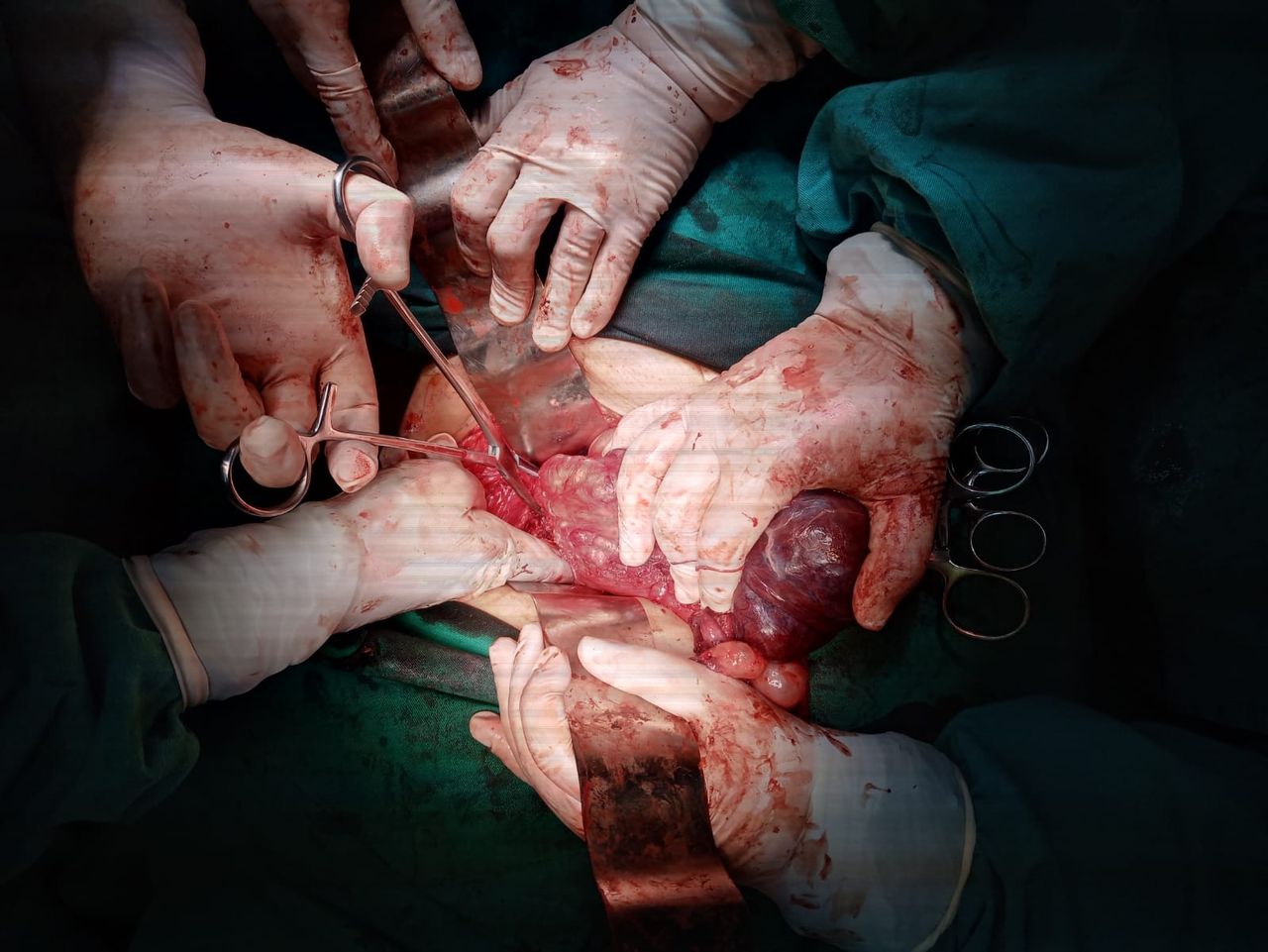 Carla  Lozada Lozada-0