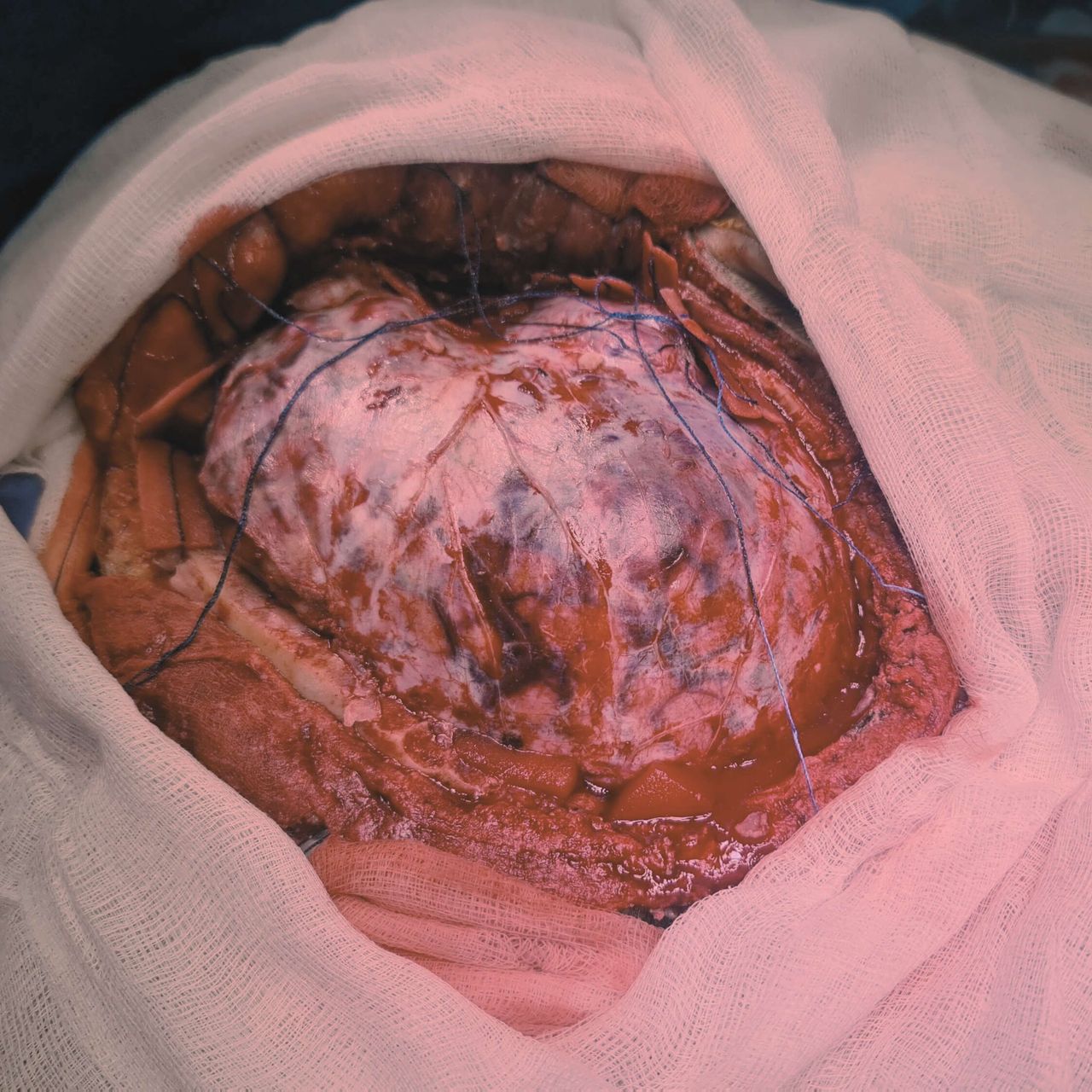 David Tafur Muñoz-3150