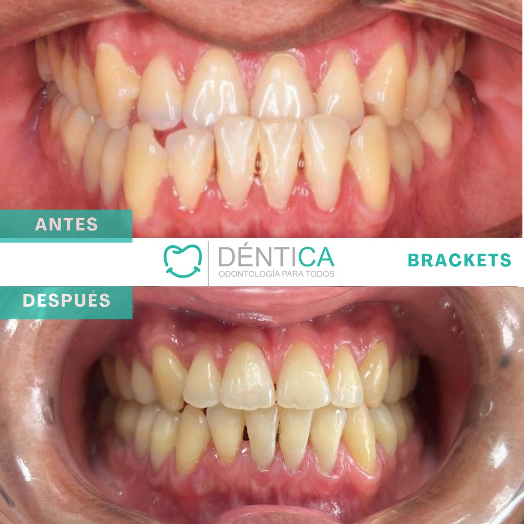 Estefani Canches Caballero-18