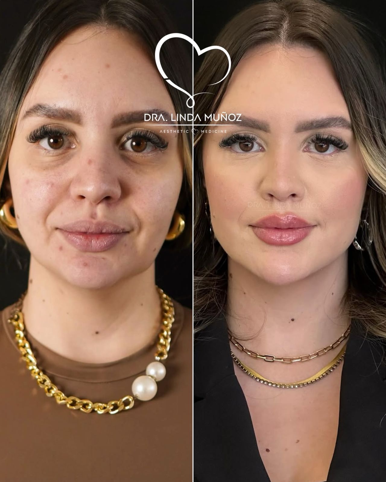 Linda Muñoz-27