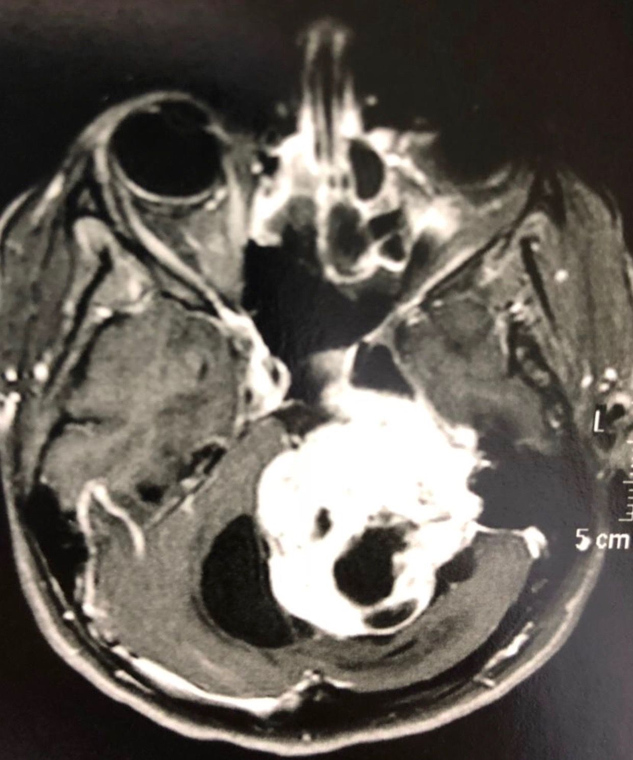 José Lopes Sousa Filho-83