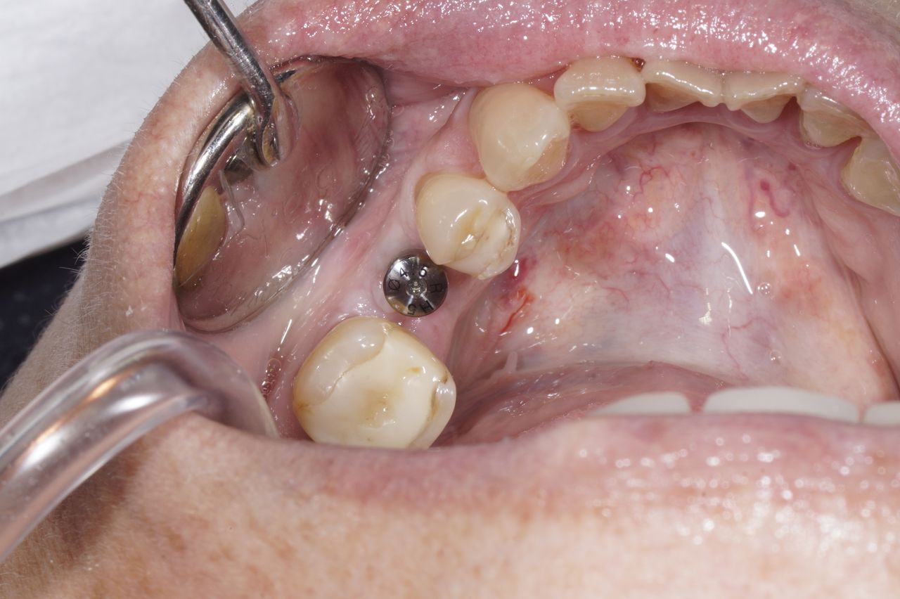 Hernán Andrés Febre Moscoso-16