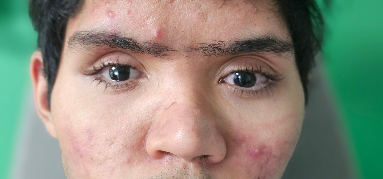 Raul Adrian Arango Orejuela-2