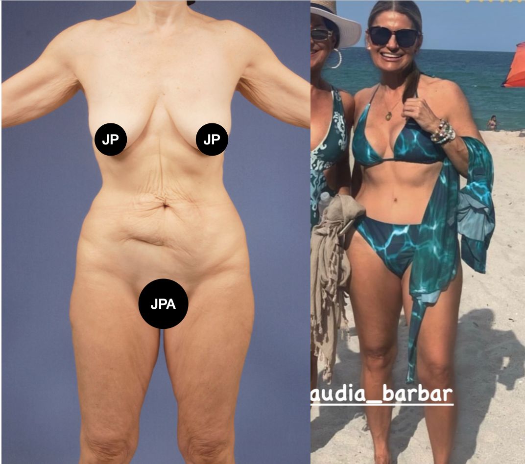 Juan Pablo Arbeláez Sierra-9