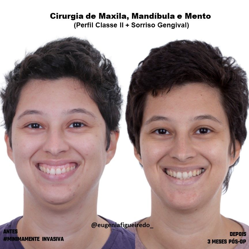Eugênia Figueiredo-18