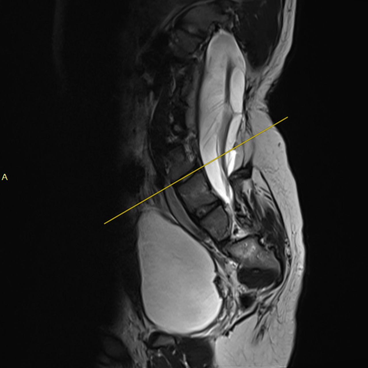 David Tafur Muñoz-1948