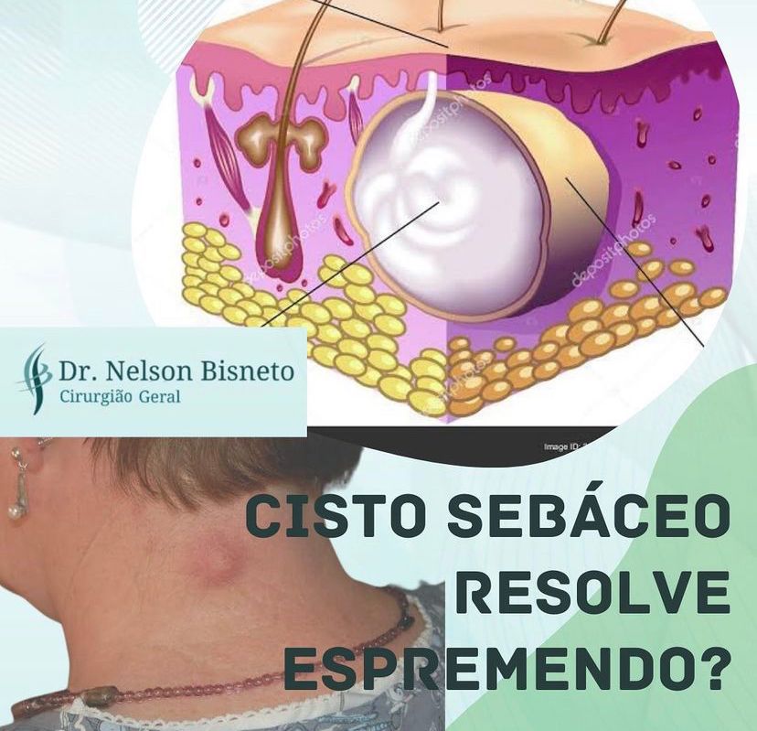 Nelson Bisneto-84