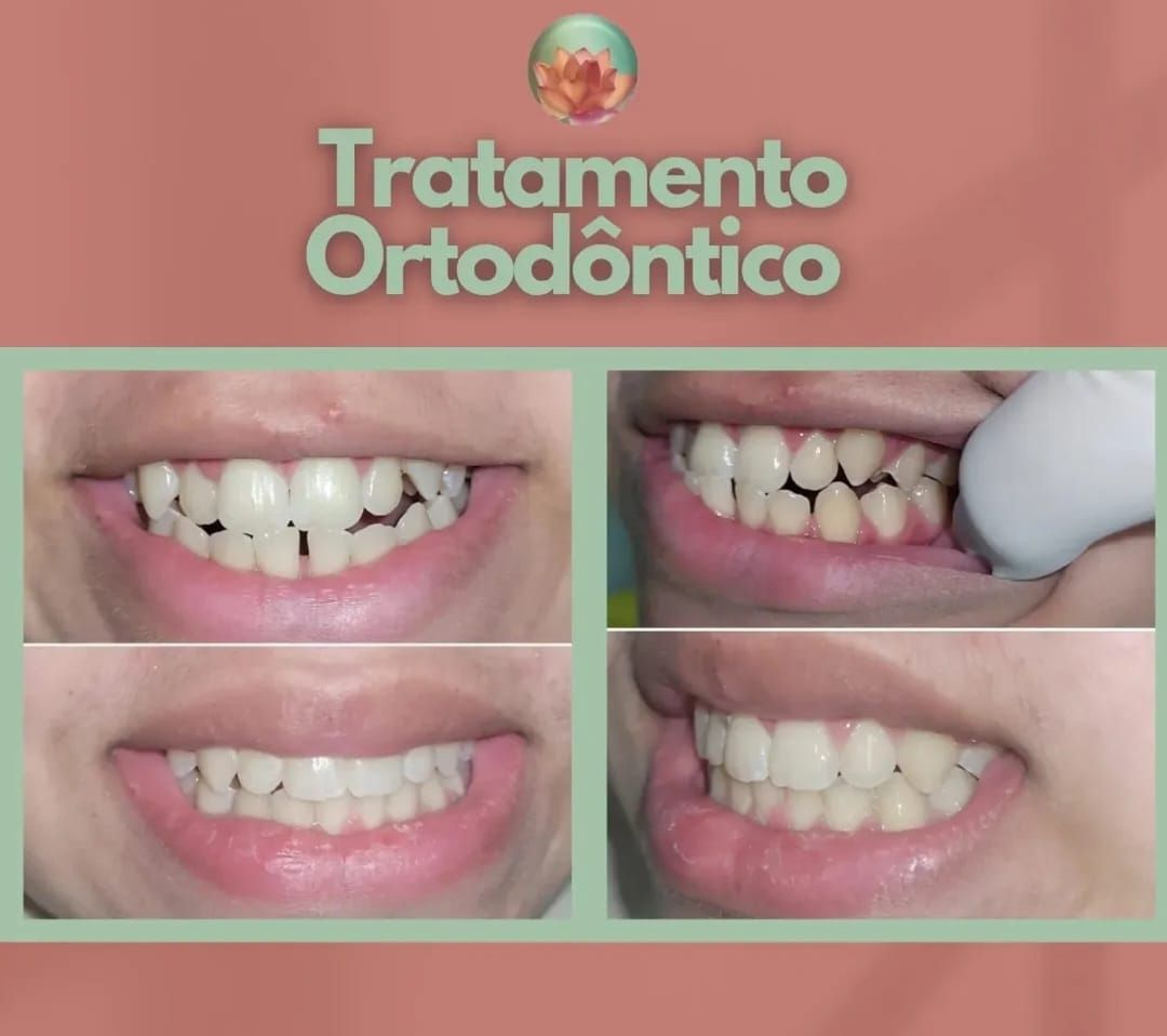 Patricia Da Costa Loreto .-2