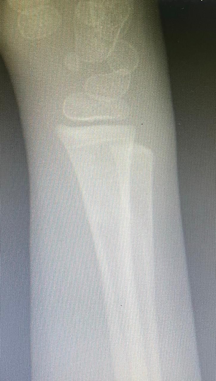 Jônatas Laurindo Giacomini-25