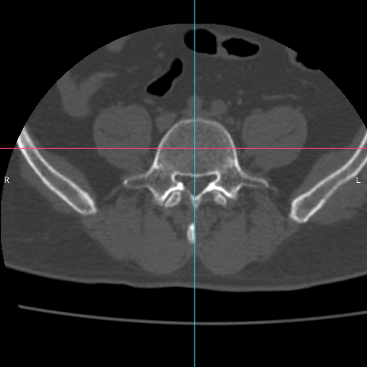 David Tafur Muñoz-2170