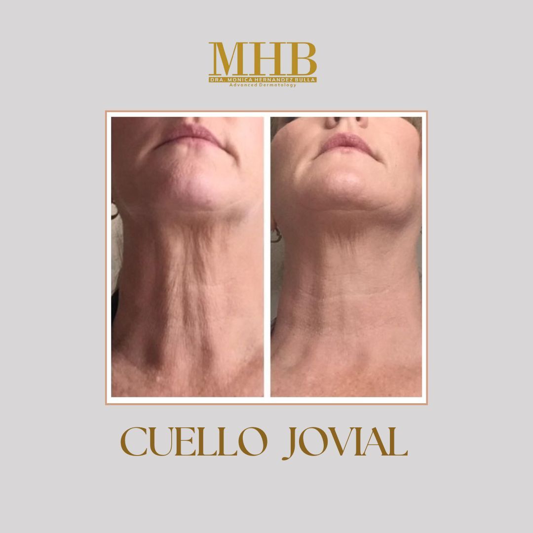 Mónica Hernandez Bulla-30