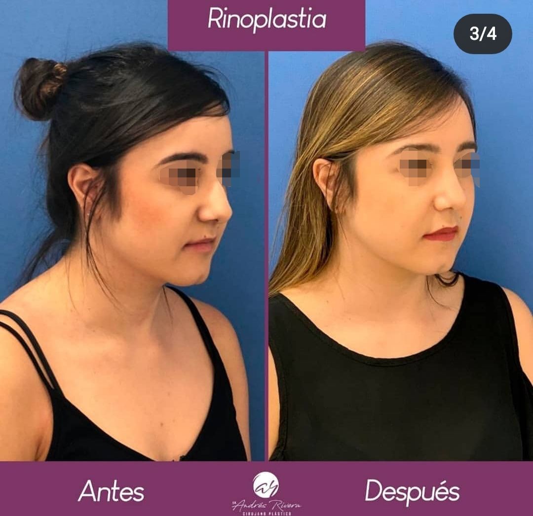 Andrés Rivera López-20