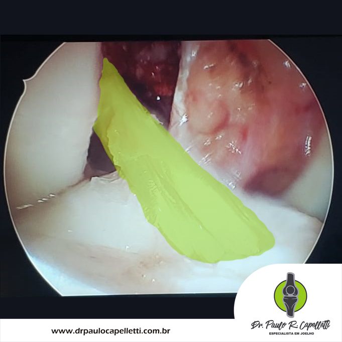 Paulo Roberto Capelletti-59