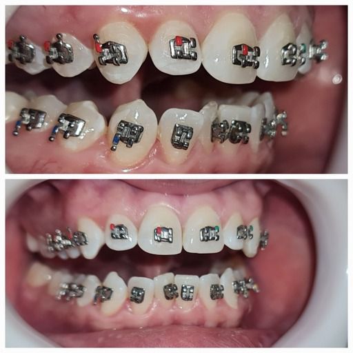 J. David Ronquillo Mackliff-3