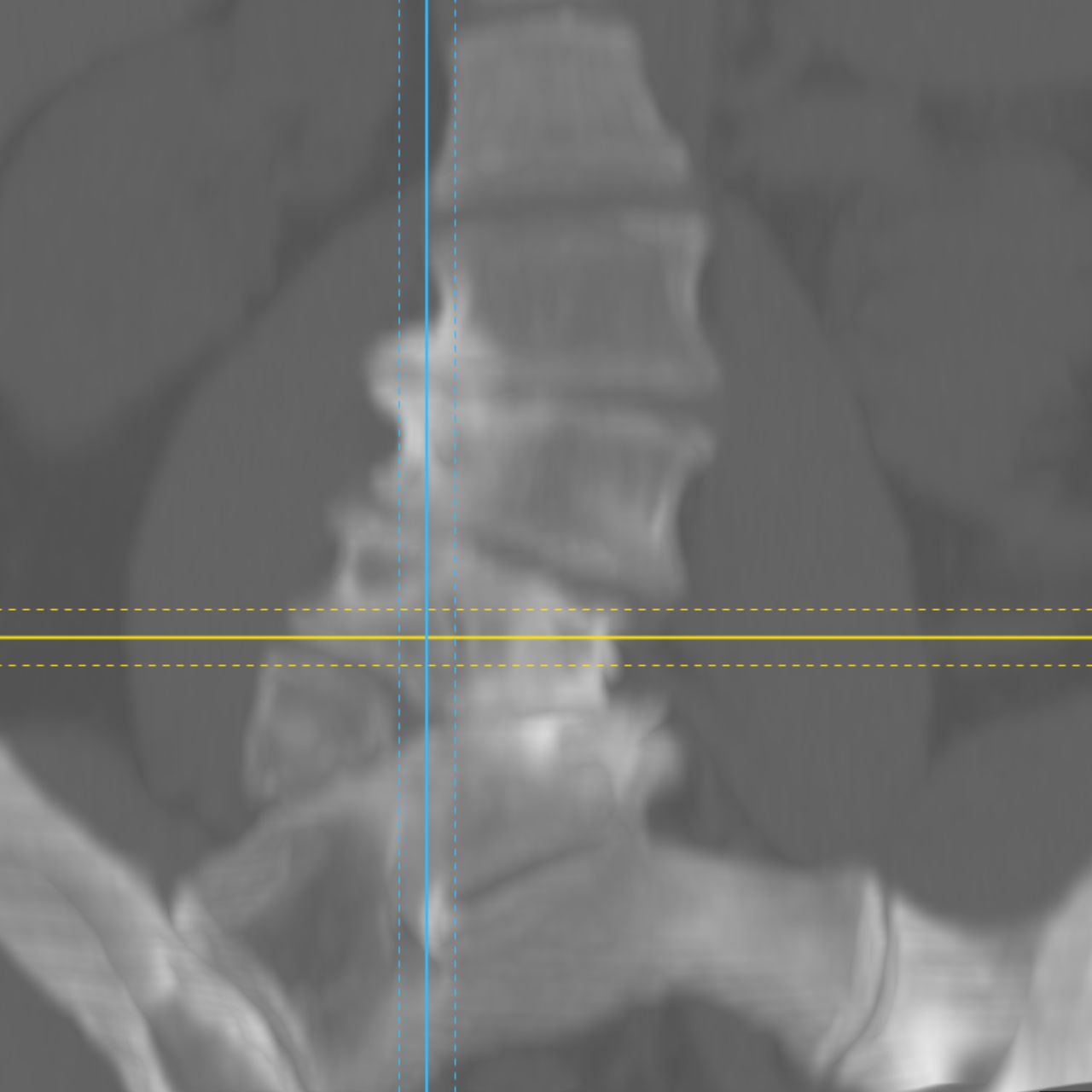 David Tafur Muñoz-2240