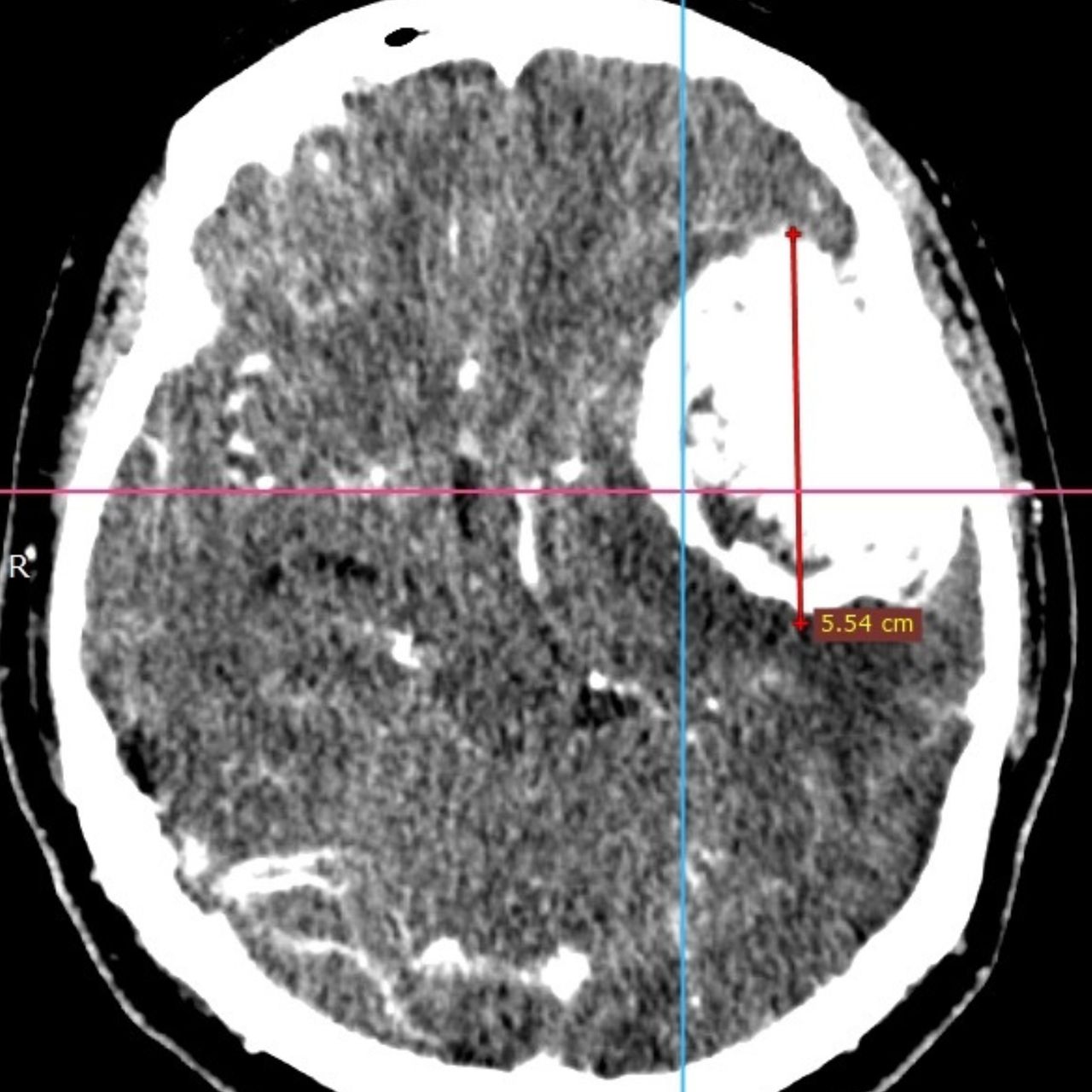 David Tafur Muñoz-1363