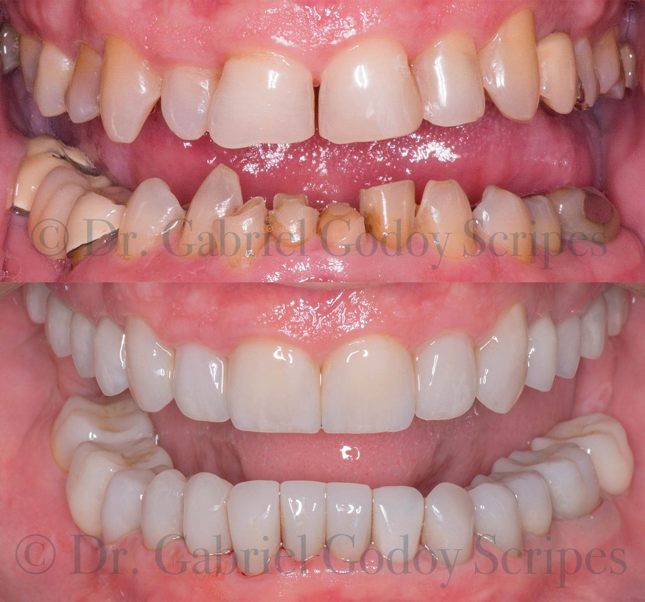 Gabriel Godoy Scripes-48