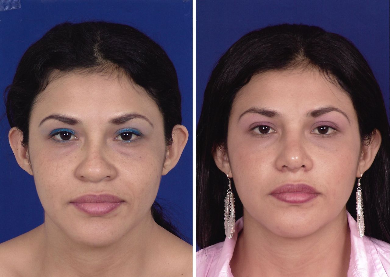 Jorge A Holguin Ruiz-33