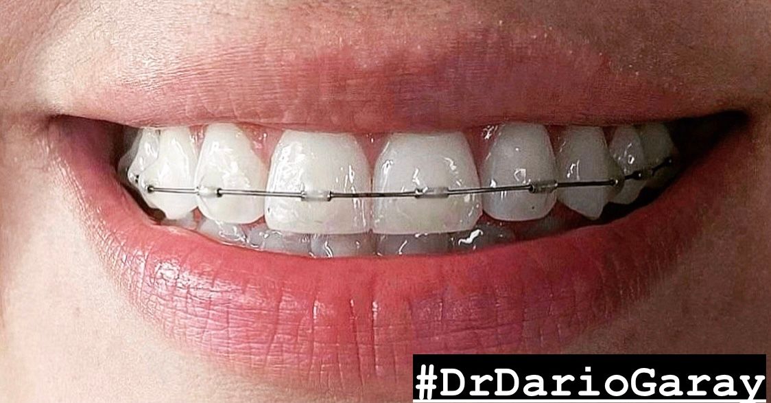 Dario Antonio Garay Chaustre-14