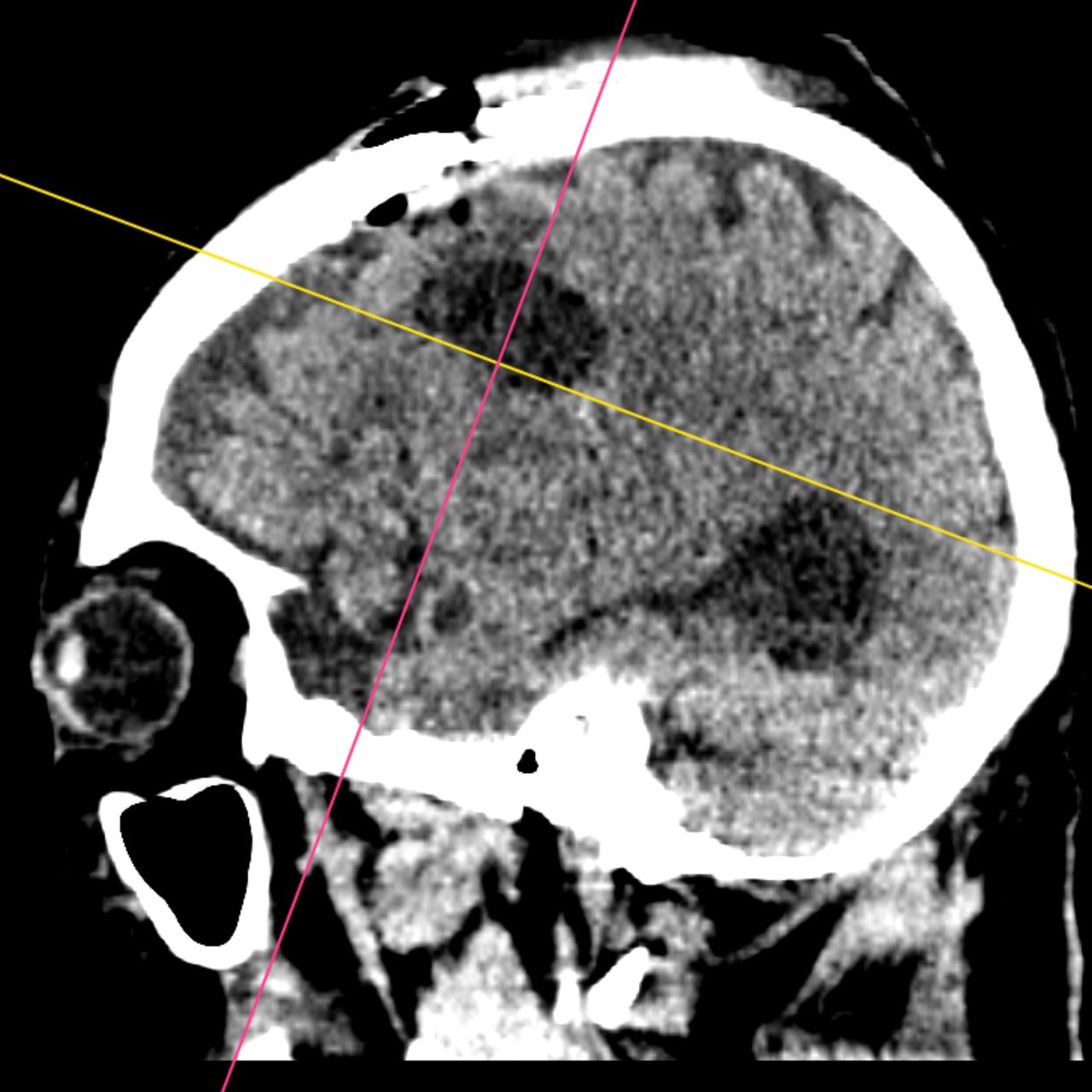 David Tafur Muñoz-1513