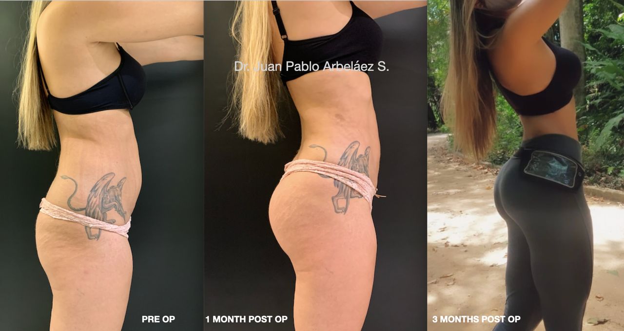 Juan Pablo Arbeláez Sierra-16