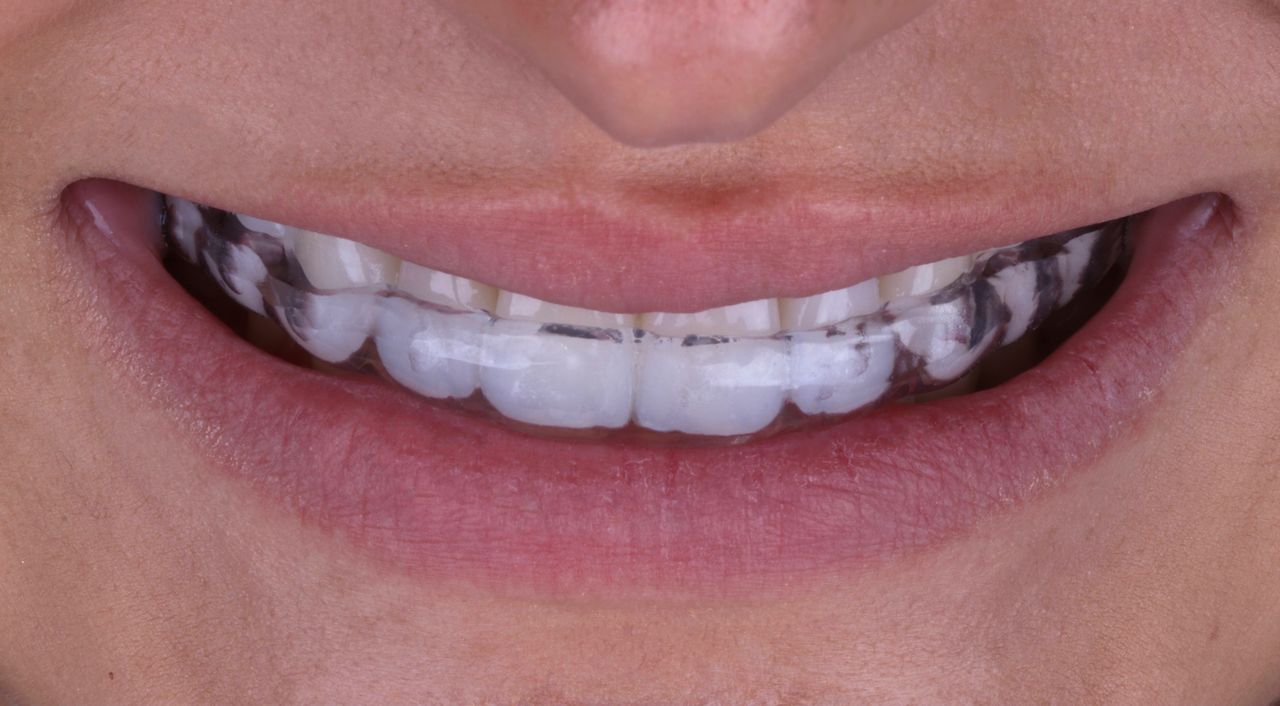 Daniel De Souza Pereira-29